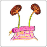 L ureterostomie Union D Associations Fran aises De Stomis s